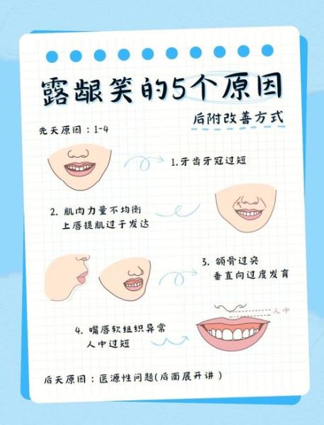 生活需要笑脸吗_如何保持微笑