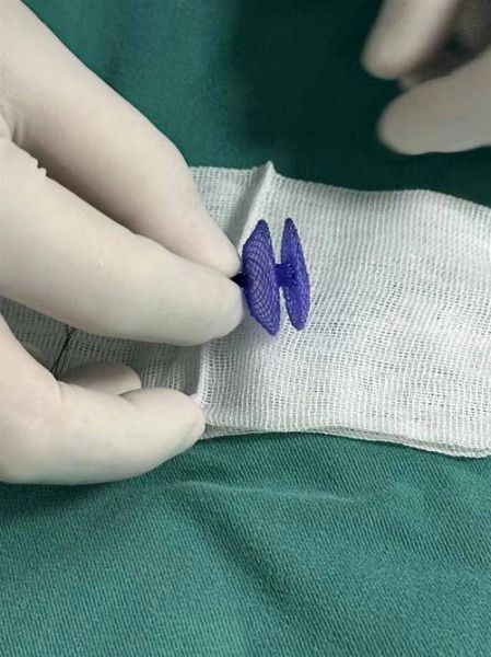 先健科技产品有哪些_先健科技心脏封堵器怎么样