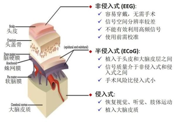 什么是脑机接口_脑机接口有哪些冷门应用