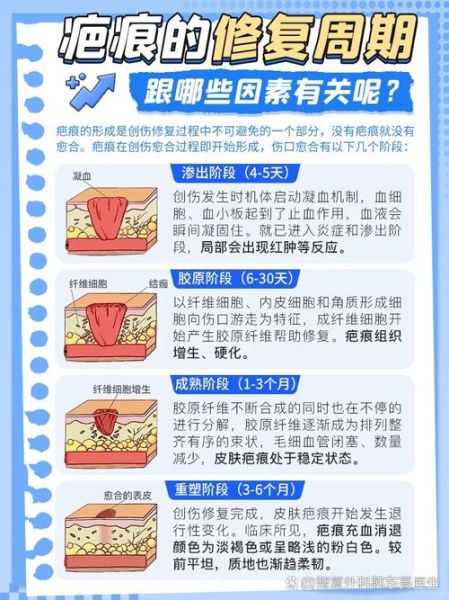 疤痕怎么淡化_疤痕修复最佳时间